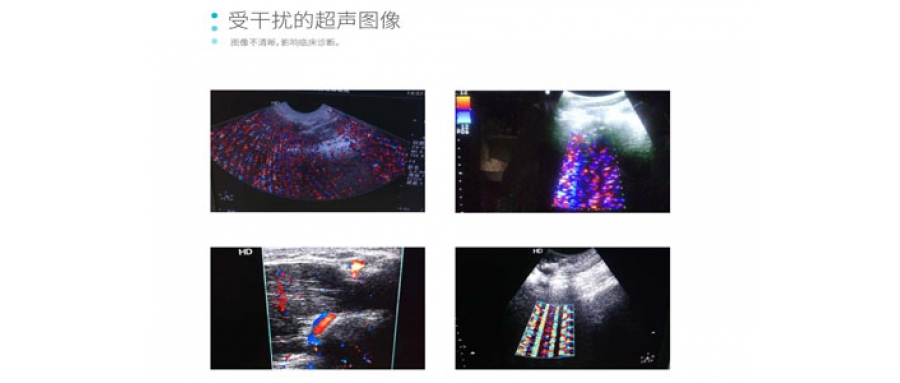 影像干擾檢測(cè)服務(wù)
